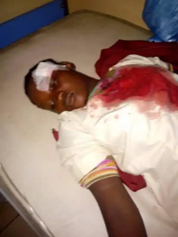 Photos of survivors of Maiduguri suicide bombing, 17 injured, no innocent life lost